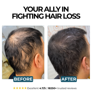 Morge™  Root Activator Shampoo