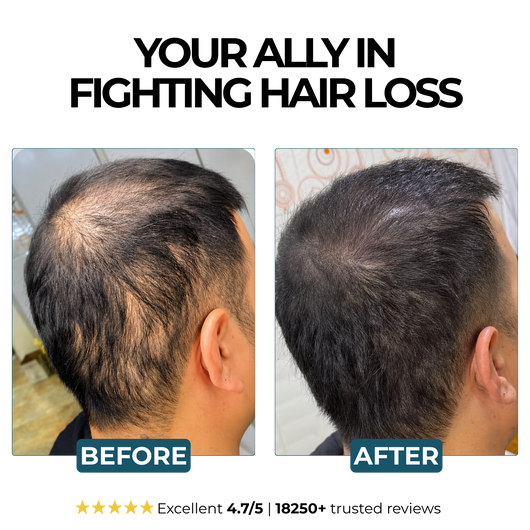 Morge™  Root Activator Shampoo