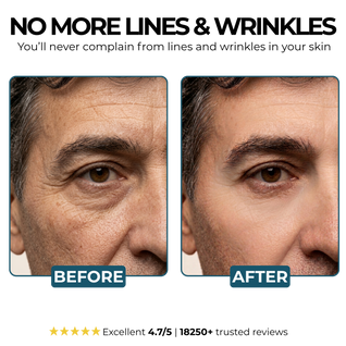 Morge™ Anti-Wrinkle Balm