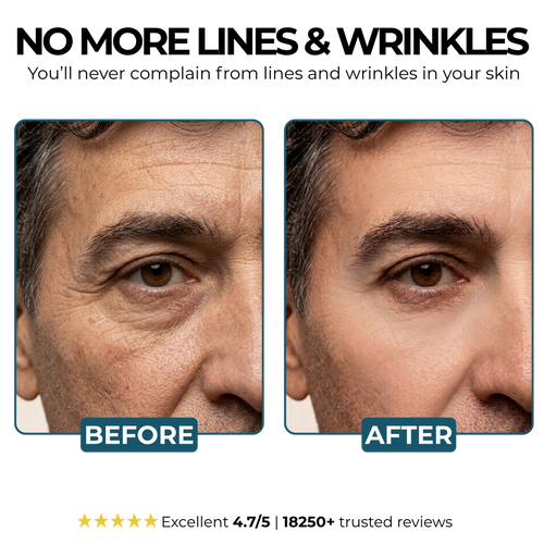 Morge™ Anti-Wrinkle Balm