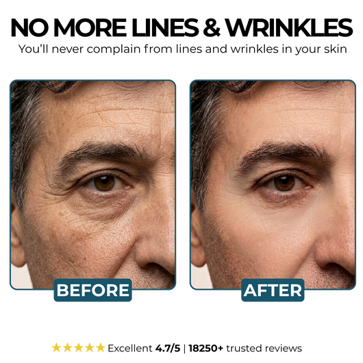 Morge™ Anti-Wrinkle Balm