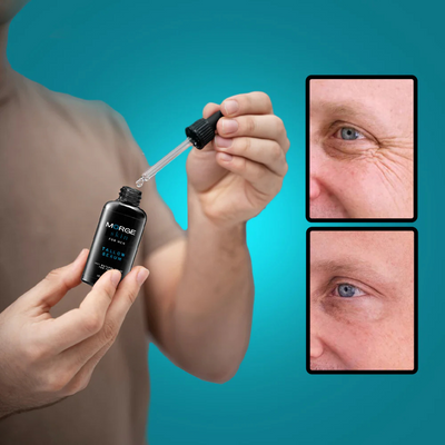 Morge™ Anti-Wrinkle Serum (FREE)